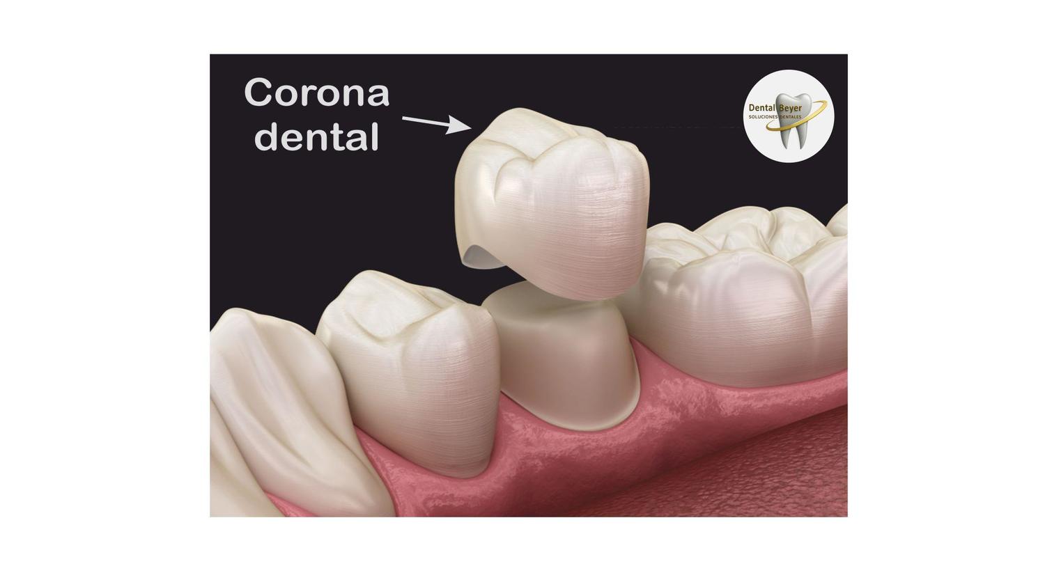 <span style="font-weight: bold;">Corona</span>&nbsp;